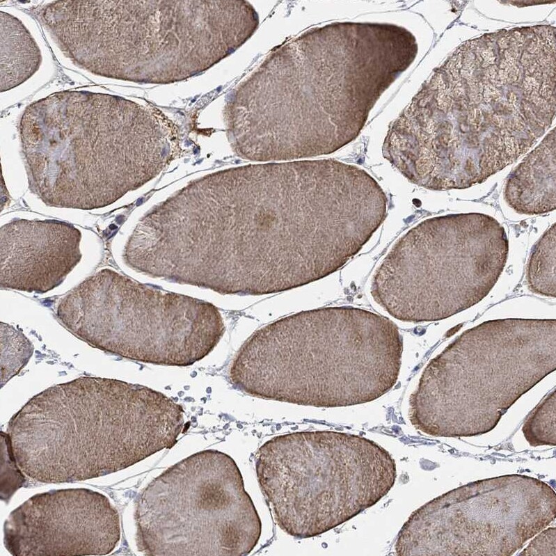 CFAP61 Antibody - BSA Free Immunohistochemistry: CFAP61 Antibody - BSA Free [NBP1-90583]