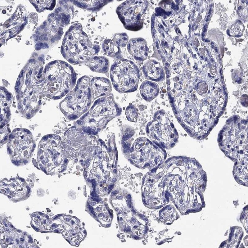 CFAP61 Antibody - BSA Free Immunohistochemistry: CFAP61 Antibody - BSA Free [NBP1-90583]