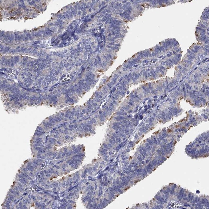 CFAP61 Antibody - BSA Free Immunohistochemistry: CFAP61 Antibody - BSA Free [NBP1-90583]