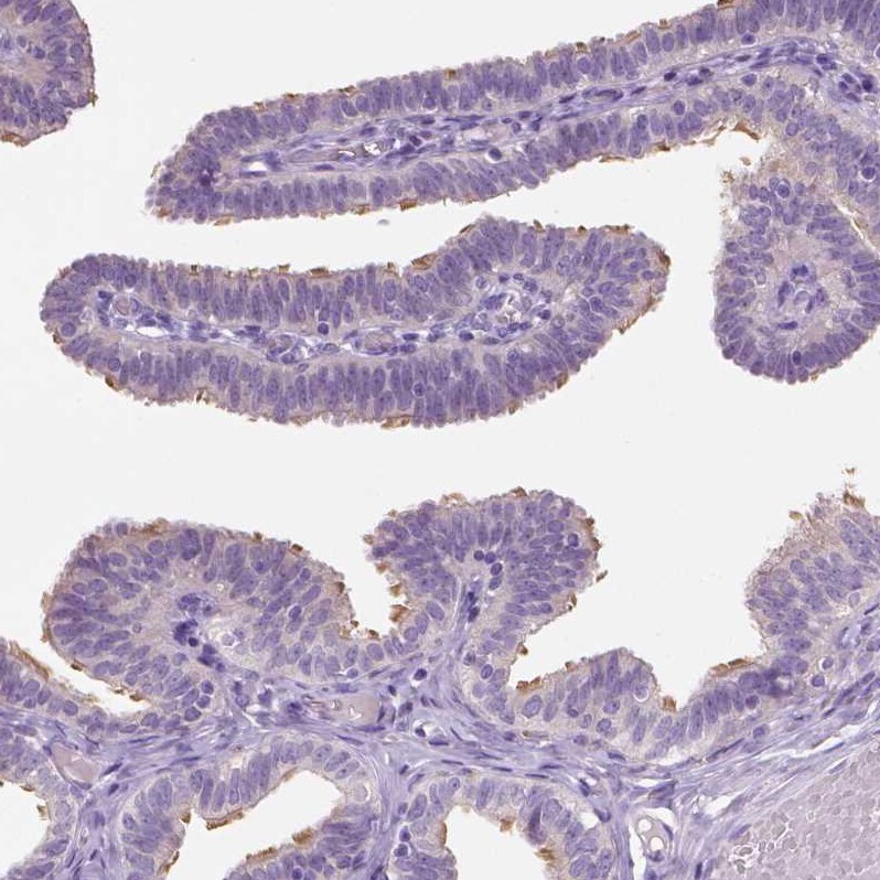 DNAH12 Antibody - BSA Free Immunohistochemistry: DNAH12 Antibody - BSA Free [NBP1-90586]