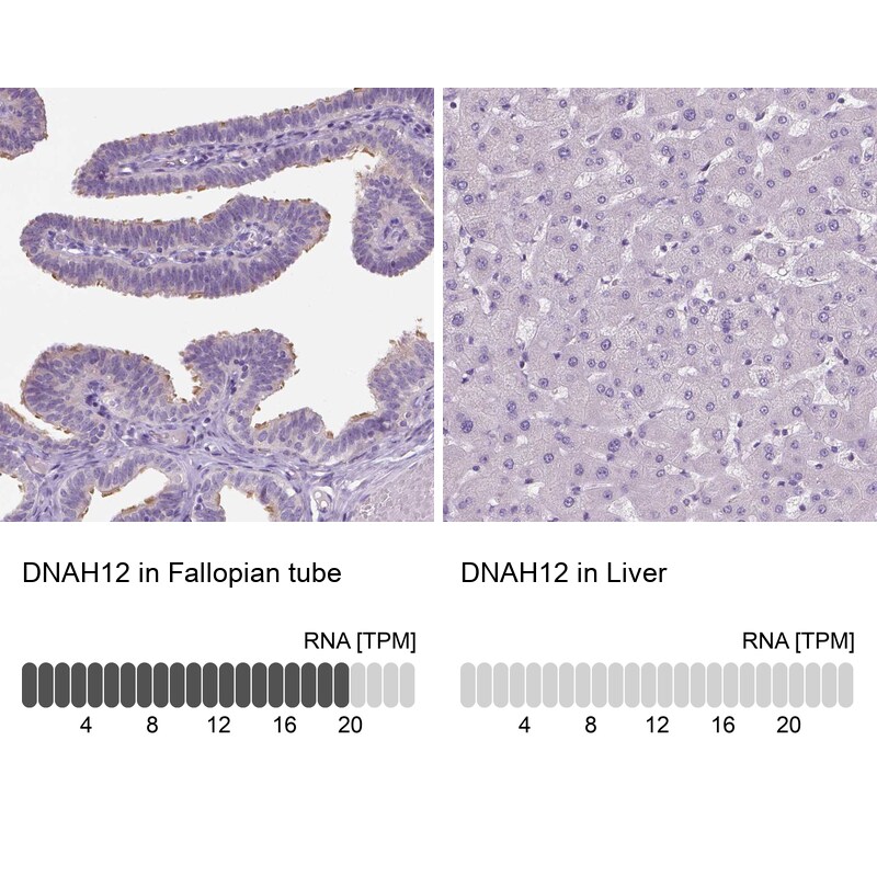 DNAH12 Antibody - BSA Free Immunohistochemistry: DNAH12 Antibody - BSA Free [NBP1-90586]