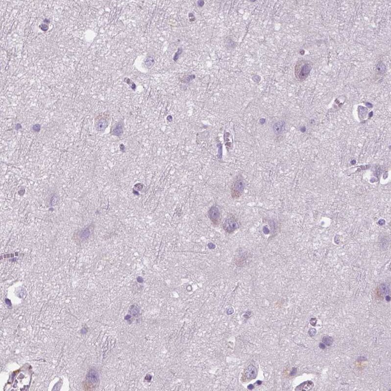 DNAH12 Antibody - BSA Free Immunohistochemistry: DNAH12 Antibody - BSA Free [NBP1-90586]