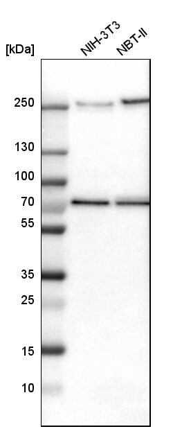 TRIOBP Antibody - BSA Free Western Blot: TRIOBP Antibody - BSA Free [NBP1-90589]