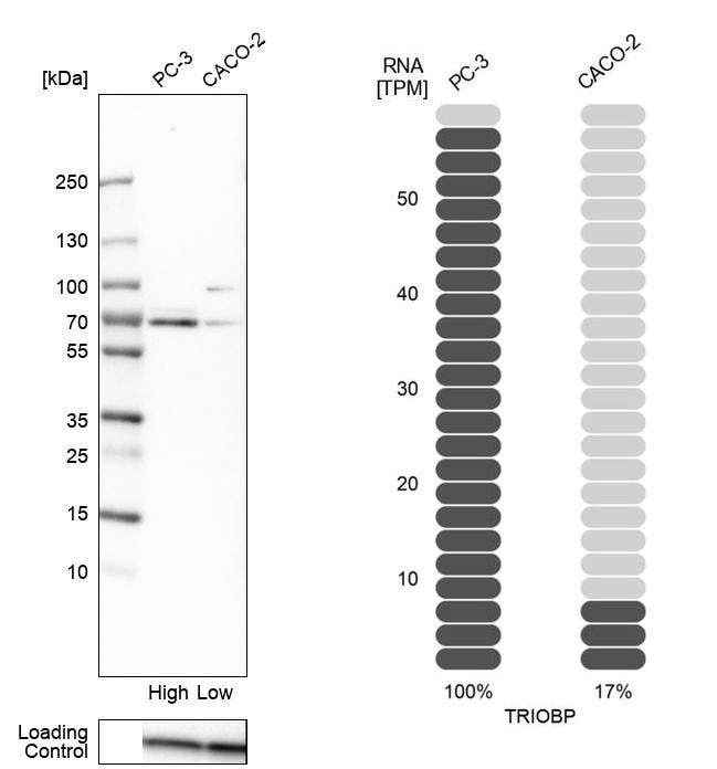 TRIOBP Antibody - BSA Free Western Blot: TRIOBP Antibody - BSA Free [NBP1-90590]