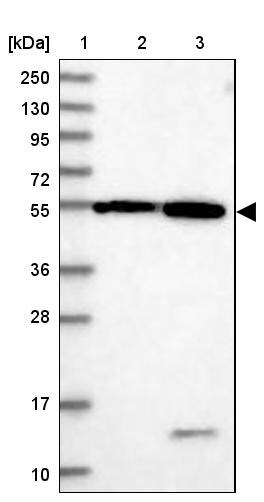 DEPDC4 Antibody - BSA Free Western Blot: DEPDC4 Antibody - BSA Free [NBP1-90592]