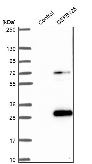 DEFB125 Antibody - BSA Free Western Blot: DEFB125 Antibody - BSA Free [NBP1-90595]
