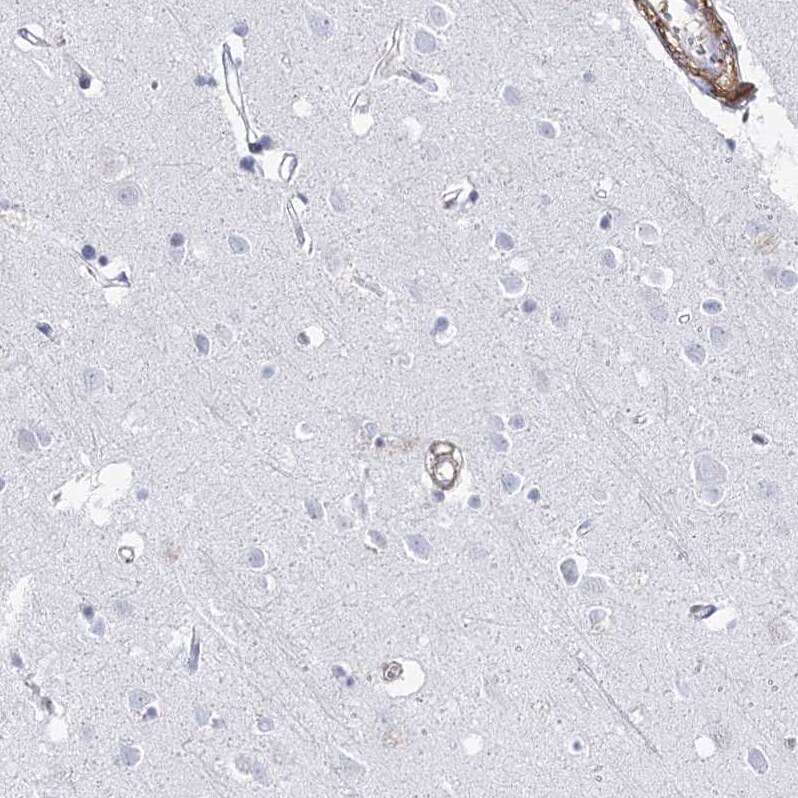 ANKRD23 Antibody - BSA Free Immunohistochemistry: ANKRD23 Antibody - BSA Free [NBP1-90599]