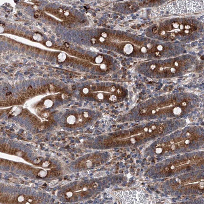 DLGAP2 Antibody - BSA Free Immunohistochemistry: DLGAP2 Antibody - BSA Free [NBP1-90602]