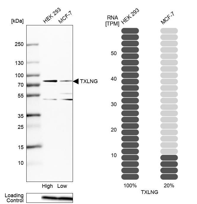 taxilin gamma Antibody - BSA Free Western Blot: taxilin gamma Antibody - BSA Free [NBP1-90606]