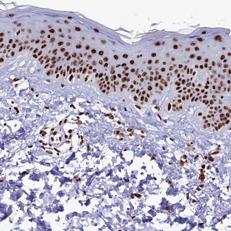 SRRM2 Antibody - BSA Free Immunohistochemistry-Paraffin: SRRM2 Antibody [NBP1-90609]