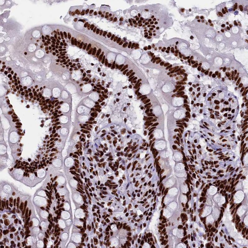 SRRM2 Antibody - BSA Free Immunohistochemistry-Paraffin: SRRM2 Antibody [NBP1-90609]