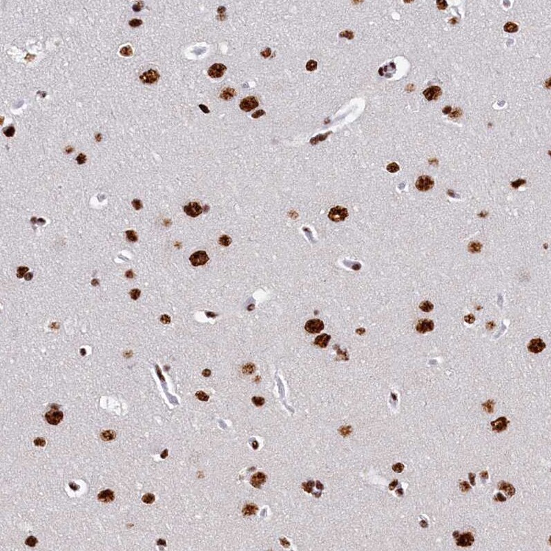 SRRM2 Antibody - BSA Free Immunohistochemistry-Paraffin: SRRM2 Antibody [NBP1-90609]