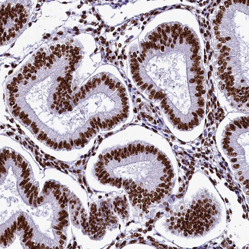 SRRM2 Antibody - BSA Free Immunohistochemistry-Paraffin: SRRM2 Antibody [NBP1-90609]