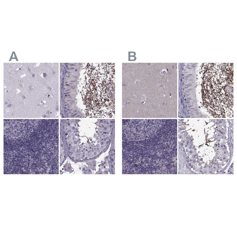 ODF3 Antibody - BSA Free Immunohistochemistry-Paraffin: ODF3 Antibody - BSA Free [NBP1-90614]
