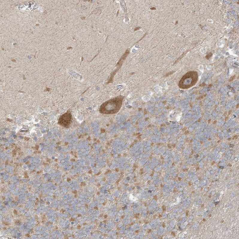 CNP/NPPC Antibody - BSA Free Immunohistochemistry: CNP/NPPC Antibody - BSA Free [NBP1-90623]