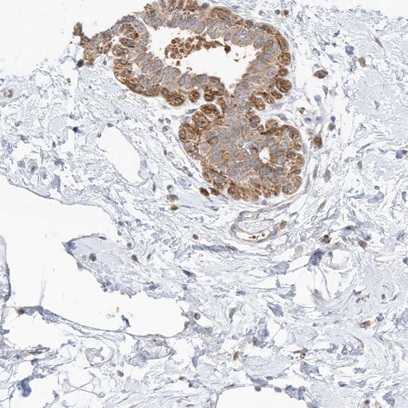 CNP/NPPC Antibody - BSA Free Immunohistochemistry: CNP/NPPC Antibody - BSA Free [NBP1-90623]