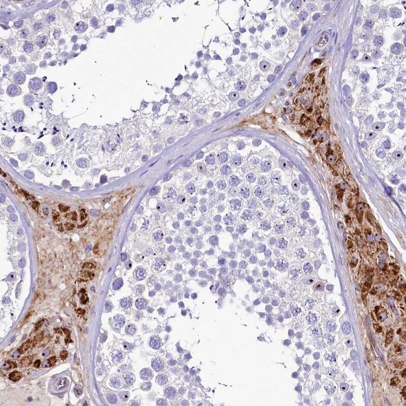 SH3TC2 Antibody - BSA Free Immunohistochemistry: SH3TC2 Antibody - BSA Free [NBP1-90624]