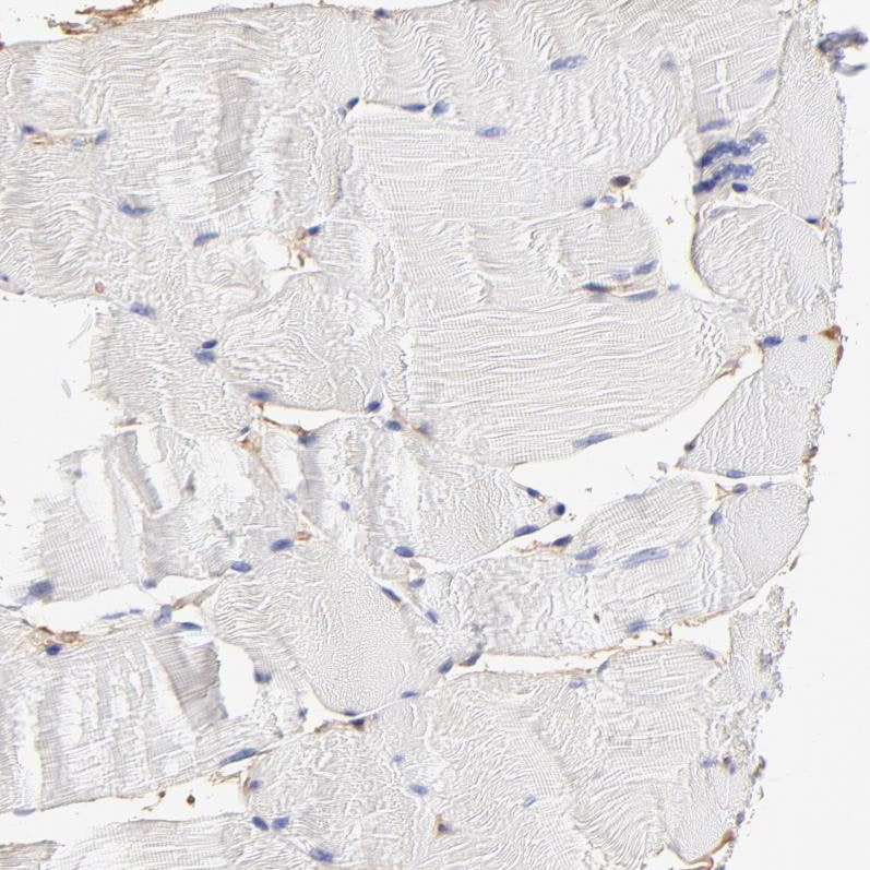 CD2AP Antibody - BSA Free Immunohistochemistry: CD2AP Antibody - BSA Free [NBP1-90625]