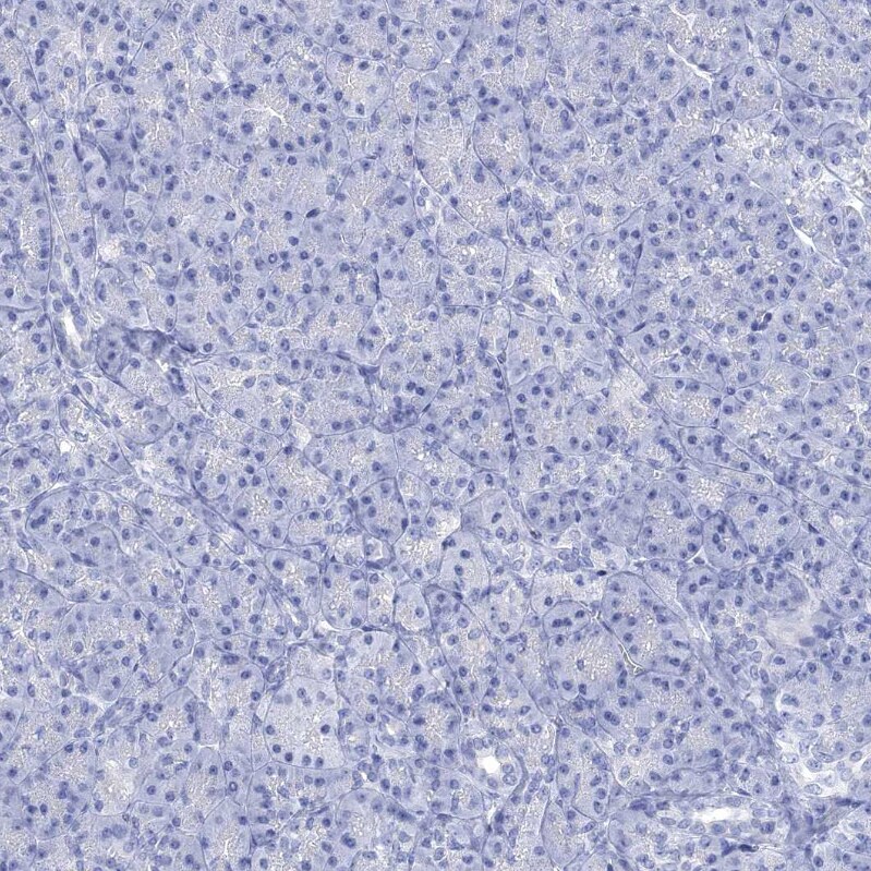 NLRP14 Antibody - BSA Free Immunohistochemistry: NLRP14 Antibody - BSA Free [NBP1-90627]