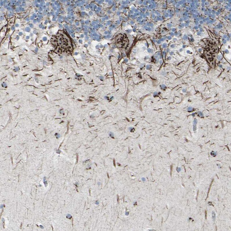 Golgi Glycoprotein 1/GLG1 Antibody - BSA Free Immunohistochemistry: Golgi Glycoprotein 1/GLG1 Antibody - BSA Free [NBP1-90636]