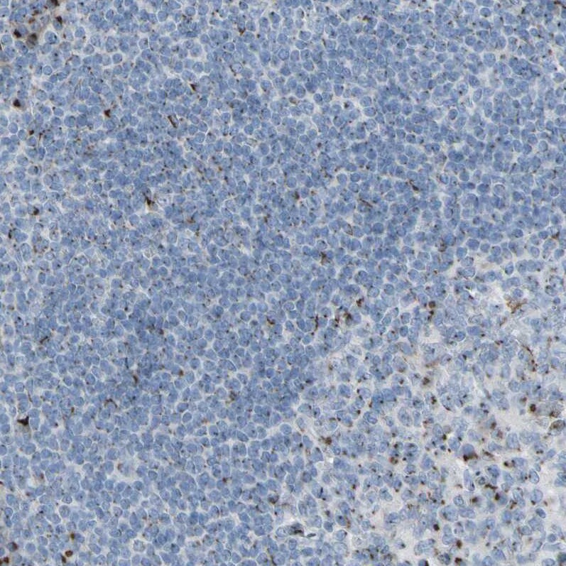 Golgi Glycoprotein 1/GLG1 Antibody - BSA Free Immunohistochemistry: Golgi Glycoprotein 1/GLG1 Antibody - BSA Free [NBP1-90636]