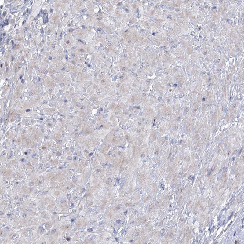 carboxylesterase 4A Antibody - BSA Free Immunohistochemistry: carboxylesterase 4A Antibody - BSA Free [NBP1-90638]