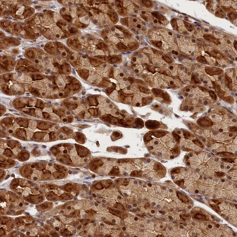 CEP44 Antibody - BSA Free Immunohistochemistry: CEP44 Antibody - BSA Free [NBP1-90640]