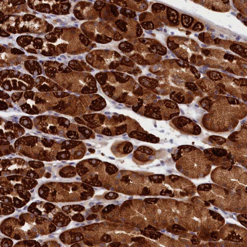 CEP44 Antibody - BSA Free Immunohistochemistry: CEP44 Antibody - BSA Free [NBP1-90641]