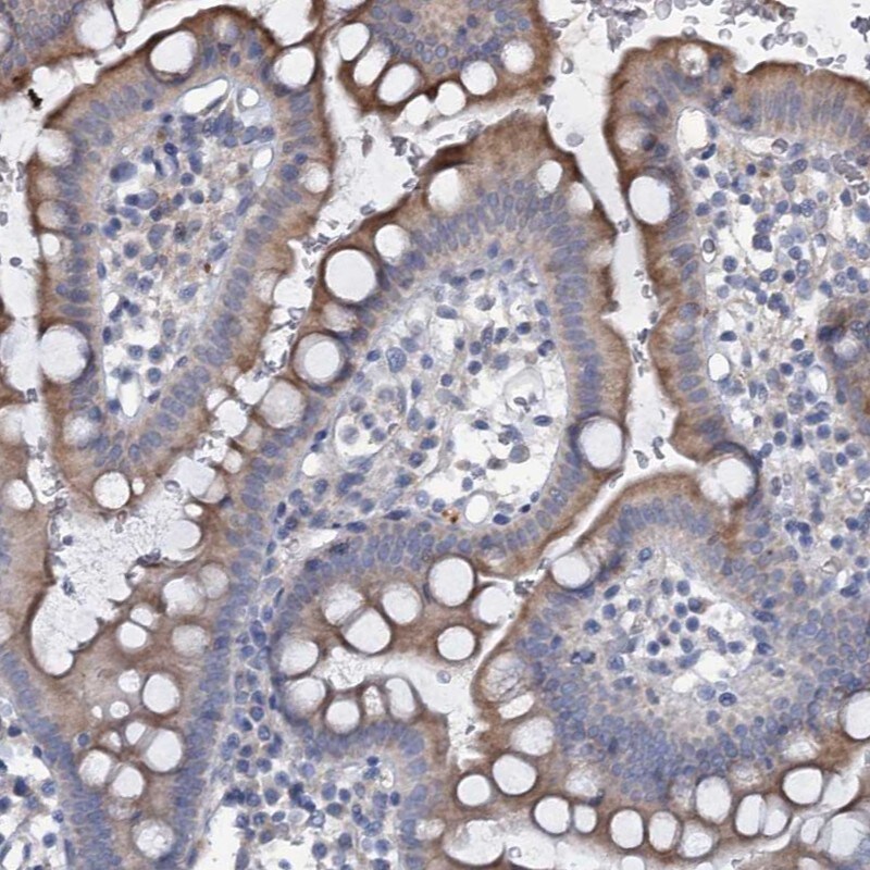 PRHOXNB Antibody - BSA Free Immunohistochemistry: PRHOXNB Antibody - BSA Free [NBP1-90645]