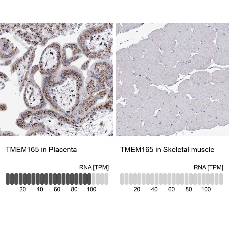 TMEM165 Antibody - BSA Free Immunohistochemistry-Paraffin: TMEM165 Antibody [NBP1-90651]