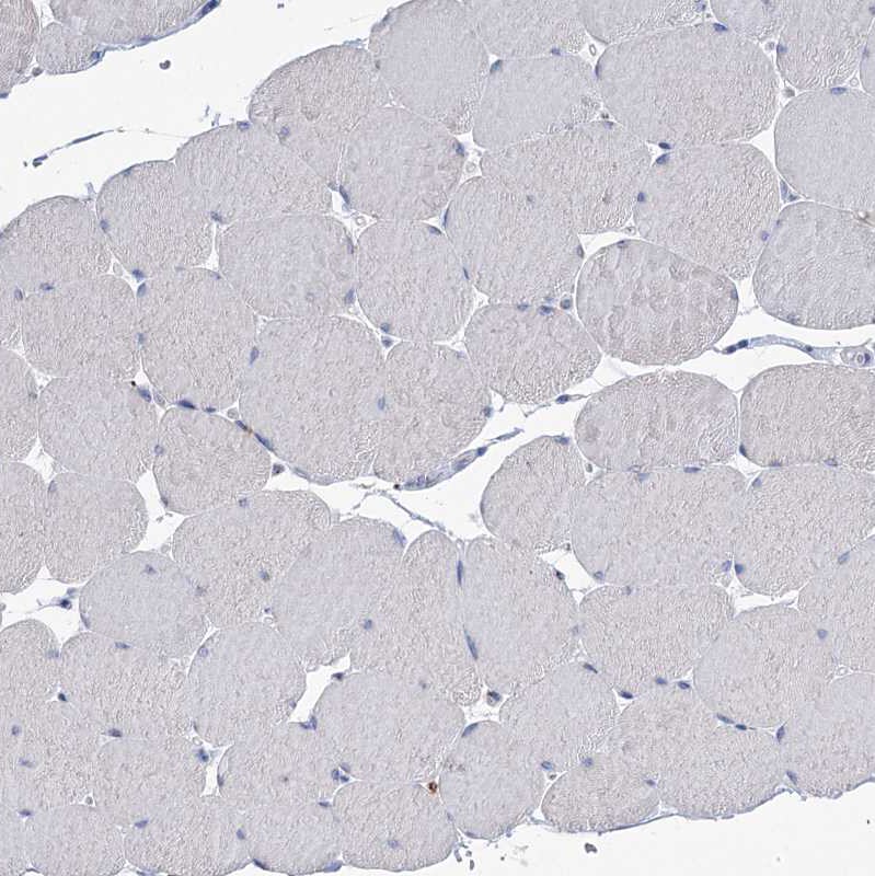 TMEM165 Antibody - BSA Free Immunohistochemistry-Paraffin: TMEM165 Antibody [NBP1-90651]
