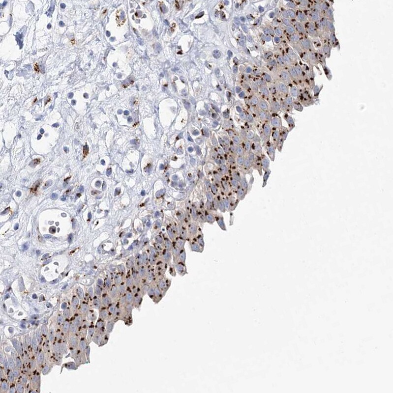 TMEM165 Antibody - BSA Free Immunohistochemistry-Paraffin: TMEM165 Antibody [NBP1-90651]