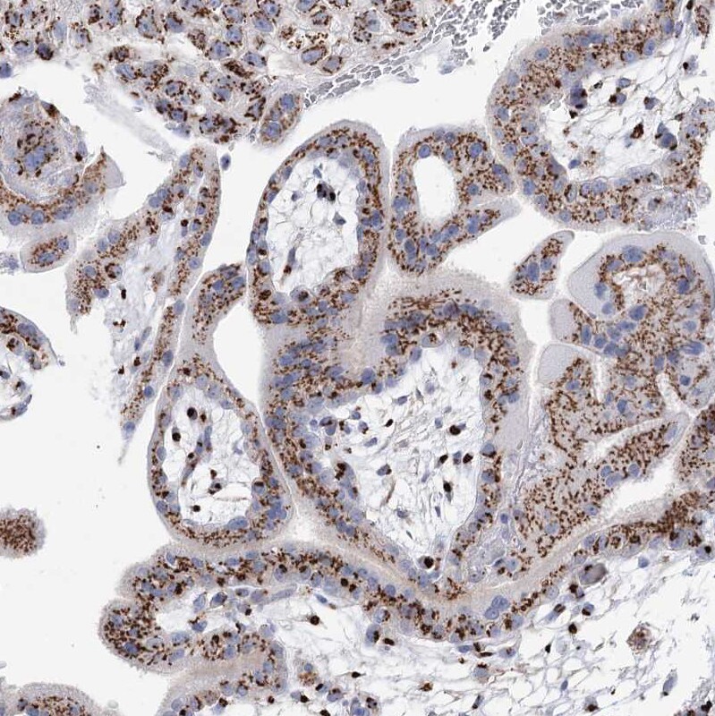 TMEM165 Antibody - BSA Free Immunohistochemistry-Paraffin: TMEM165 Antibody [NBP1-90651]