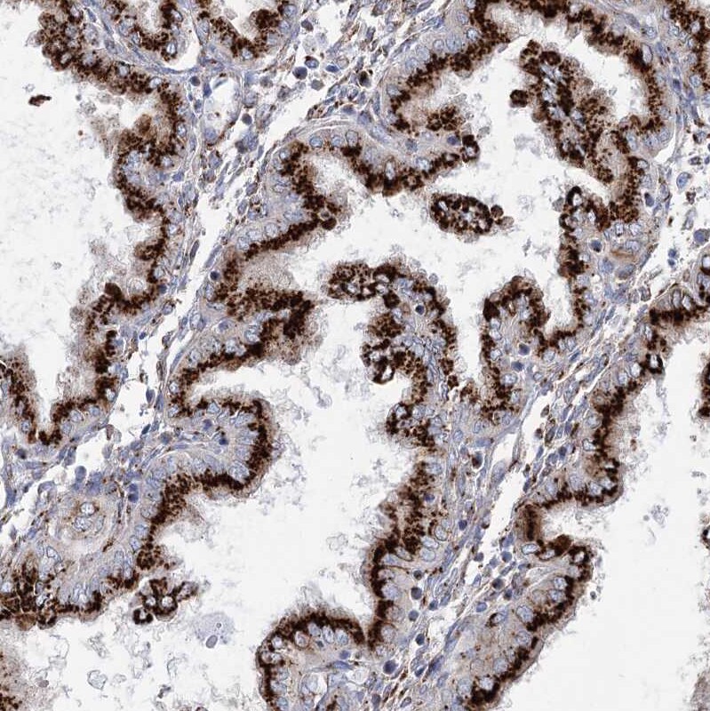 TMEM165 Antibody - BSA Free Immunohistochemistry-Paraffin: TMEM165 Antibody [NBP1-90651]