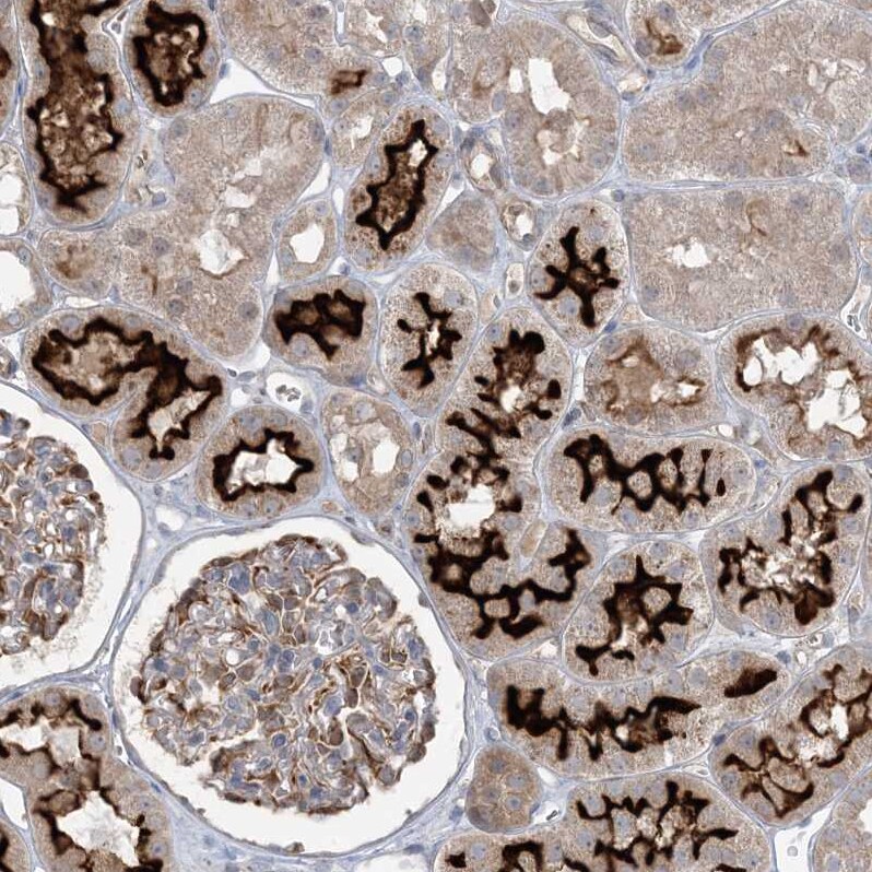 MMGT1 Antibody - BSA Free Immunohistochemistry: MMGT1 Antibody - BSA Free [NBP1-90652]