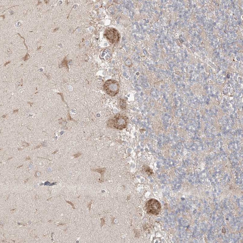 MMGT1 Antibody - BSA Free Immunohistochemistry: MMGT1 Antibody - BSA Free [NBP1-90652]