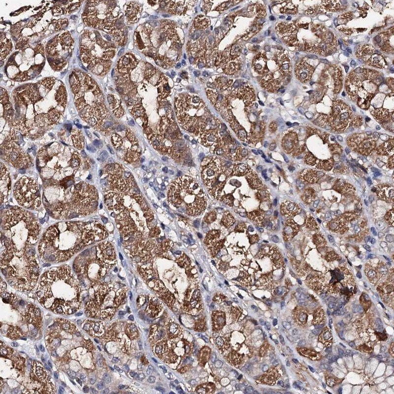 PPTC7 Antibody - BSA Free Immunohistochemistry-Paraffin: PPTC7 Antibody [NBP1-90653]