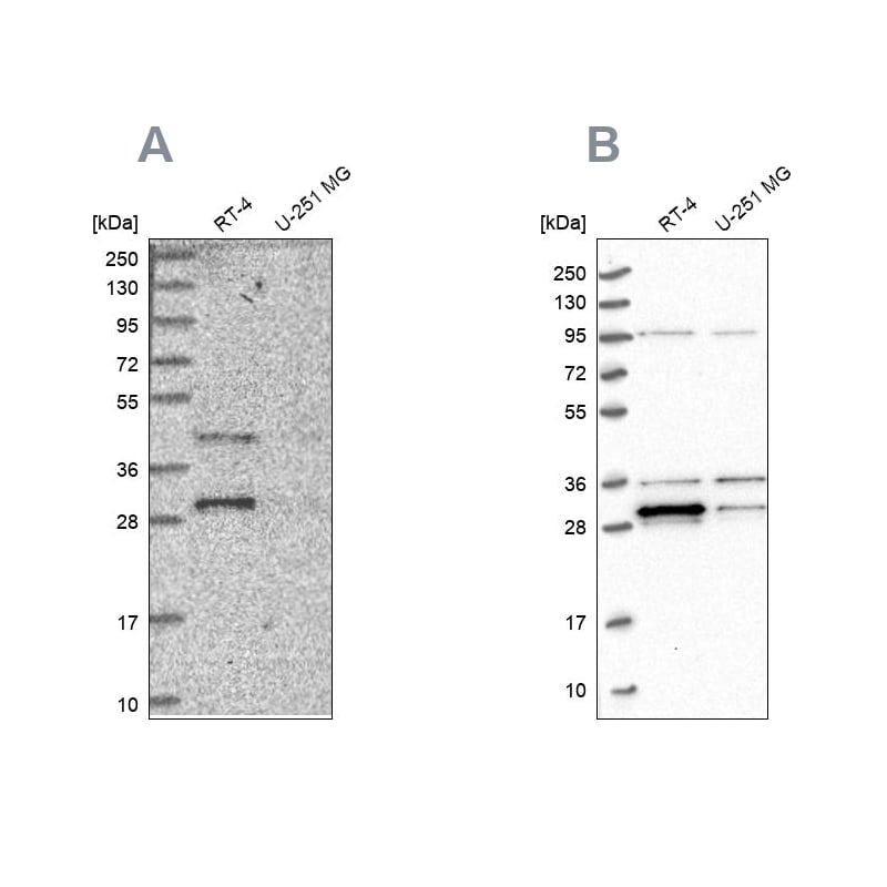 PPTC7 Antibody - BSA Free Western Blot: PPTC7 Antibody - BSA Free [NBP1-90653]