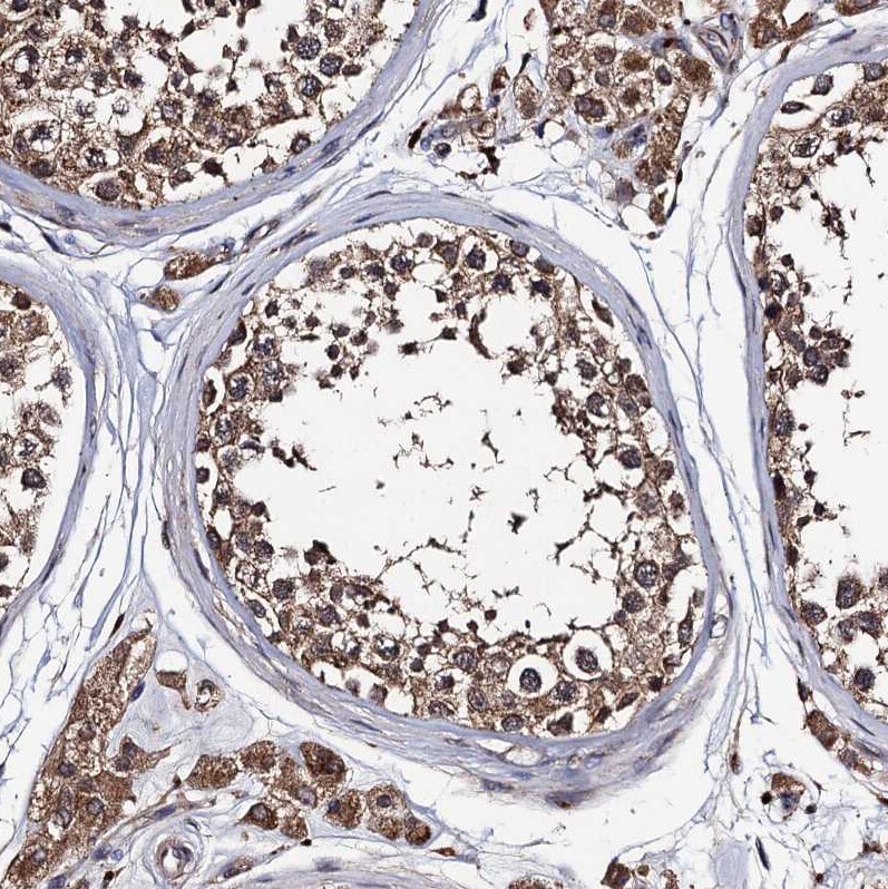 PPTC7 Antibody - BSA Free Immunohistochemistry-Paraffin: PPTC7 Antibody [NBP1-90654]