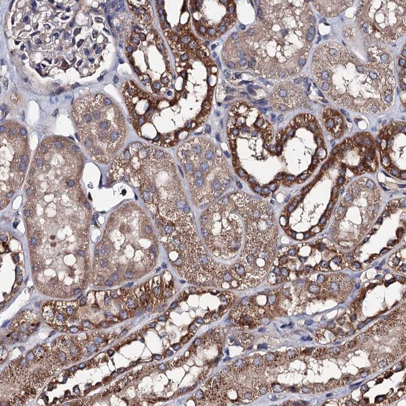 PPTC7 Antibody - BSA Free Immunohistochemistry-Paraffin: PPTC7 Antibody [NBP1-90654]