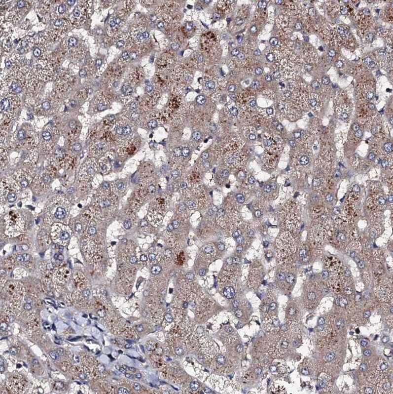 PPTC7 Antibody - BSA Free Immunohistochemistry-Paraffin: PPTC7 Antibody [NBP1-90654]