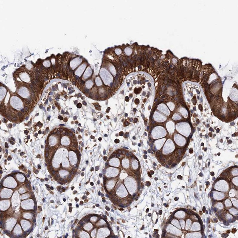 PPTC7 Antibody - BSA Free Immunohistochemistry-Paraffin: PPTC7 Antibody [NBP1-90654]