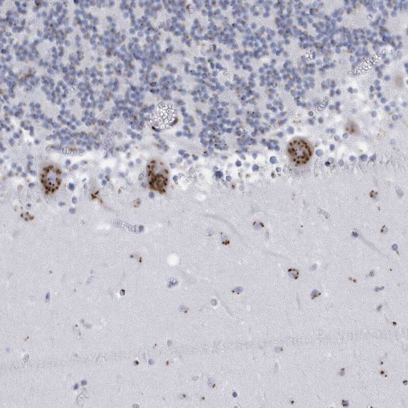 FAM207A Antibody - BSA Free Immunohistochemistry-Paraffin: FAM207A Antibody [NBP1-90676]