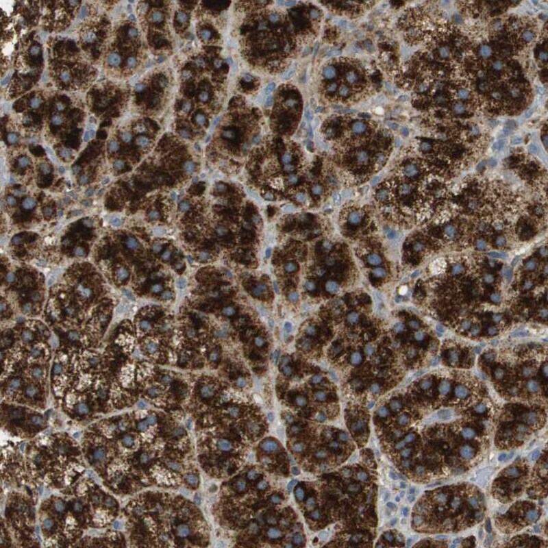 PLBD2 Antibody - BSA Free Immunohistochemistry: PLBD2 Antibody - BSA Free [NBP1-90681]