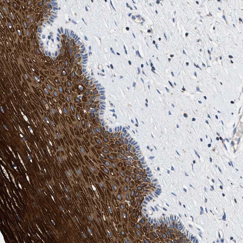 TOMM6 Antibody - BSA Free Immunohistochemistry: TOMM6 Antibody - BSA Free [NBP1-90688]