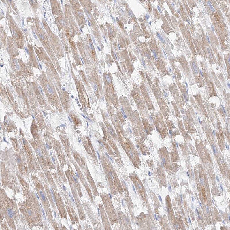 UFL1 Antibody - BSA Free Immunohistochemistry: UFL1 Antibody - BSA Free [NBP1-90693]