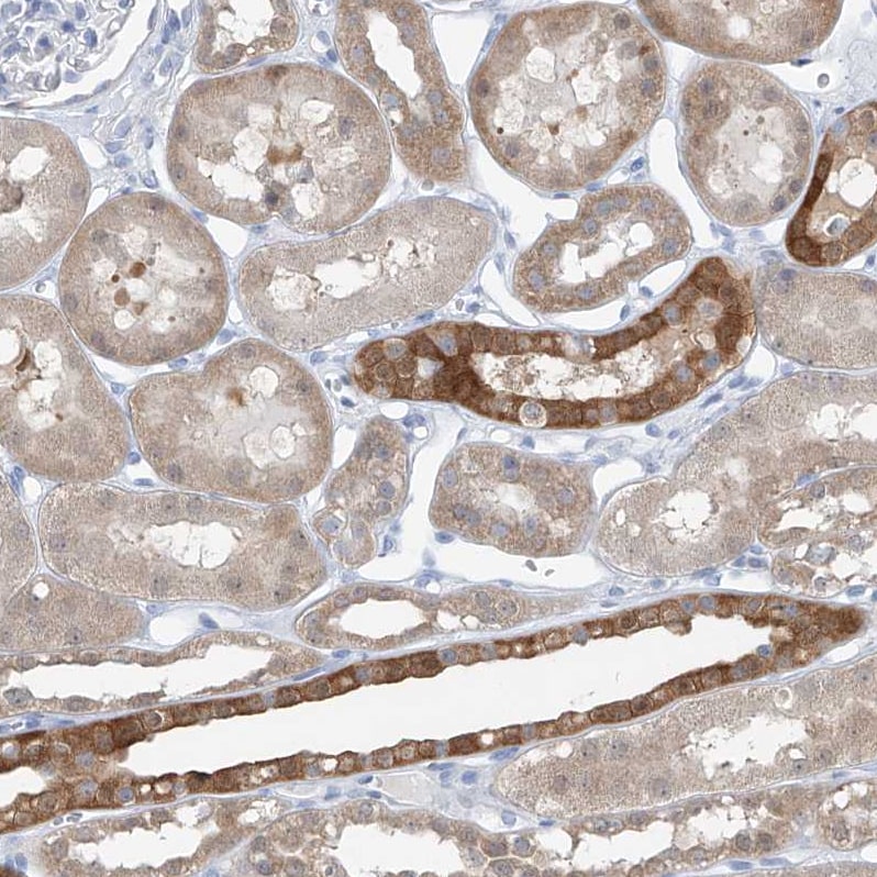 UFL1 Antibody - BSA Free Immunohistochemistry: UFL1 Antibody - BSA Free [NBP1-90693]