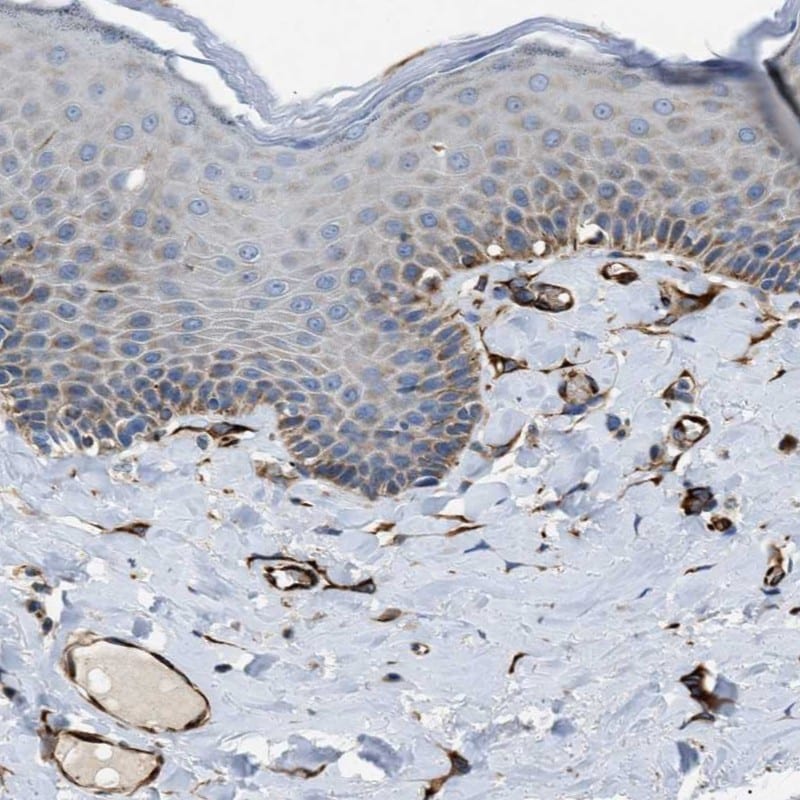 ZNF831 Antibody - BSA Free Immunohistochemistry: ZNF831 Antibody - BSA Free [NBP1-90696]