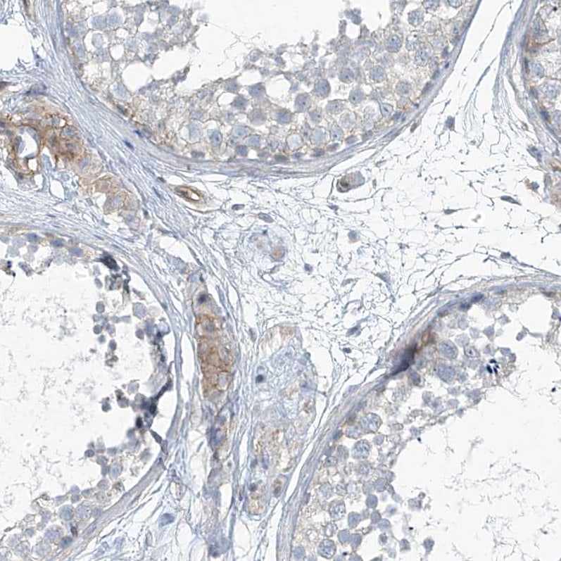 TENC1 Antibody - BSA Free Immunohistochemistry-Paraffin: TENC1 Antibody [NBP1-90698]