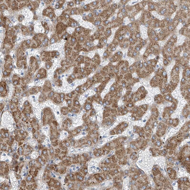 TENC1 Antibody - BSA Free Immunohistochemistry-Paraffin: TENC1 Antibody [NBP1-90698]